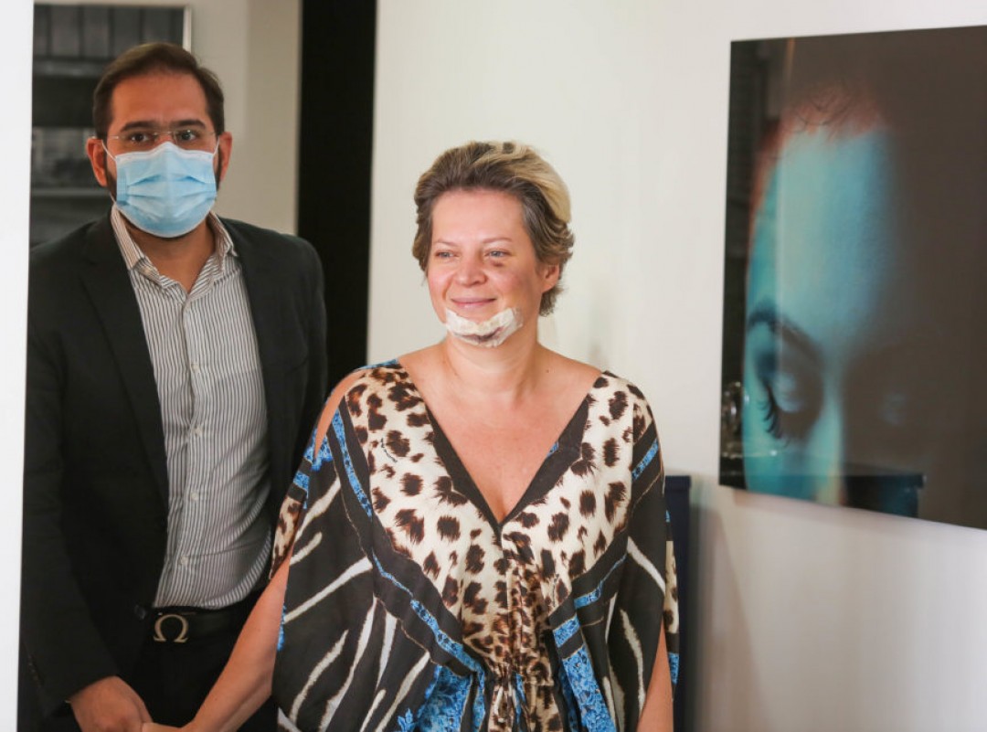 joicehasselmann-danielfranca-agressao-acidente-lesao-ferimento-412-868x644_d3565f1fbb816d81a5057c3.jpg